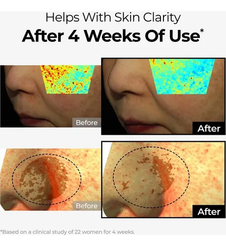 Crema Correctora De Manchas Oscuras Dominas 50g