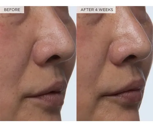 Glow Recipe Watermelon Glow PHA+BHA Pore-Tight Toner