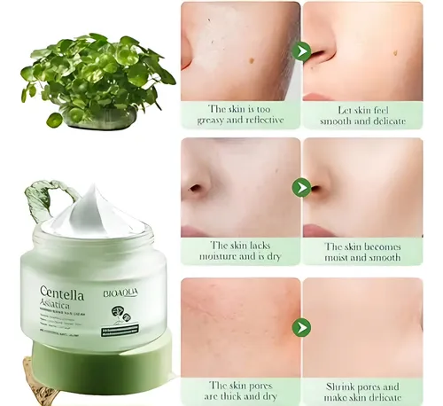 Crema Facial Anti Acne Centella Asiatica Bioaqua Bioaqua
