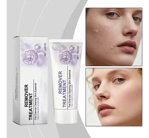 Crema Removedora Portátil Para Ojos Y Cara, Eliminadora De M
