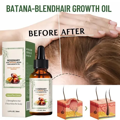 Aceite Capilar Battana 30 Ml (1 Unidad)