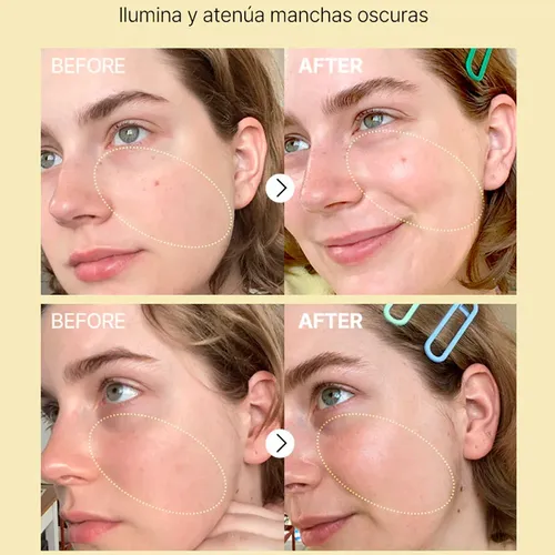 Serum Vitamina C Antioxidante Cosrx The Vitamin C 23 Serum