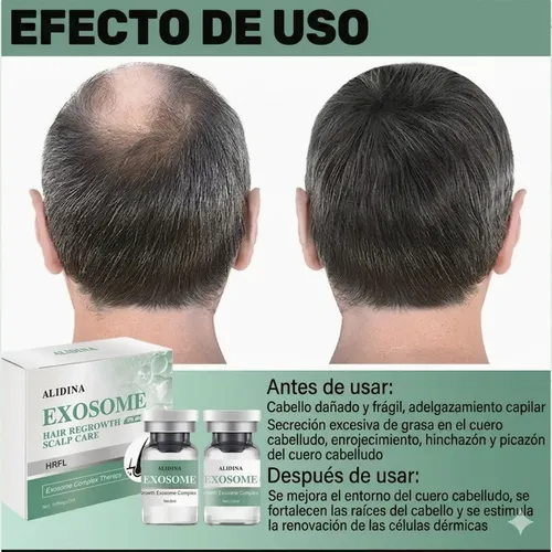 Serum Cuero Cabelludo Exosome Hrlv Fortalecedor Folicular