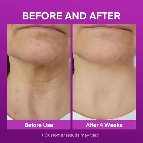 Crema Reafirmante Para Cuello Vigority 3 Unidades Con Péptid