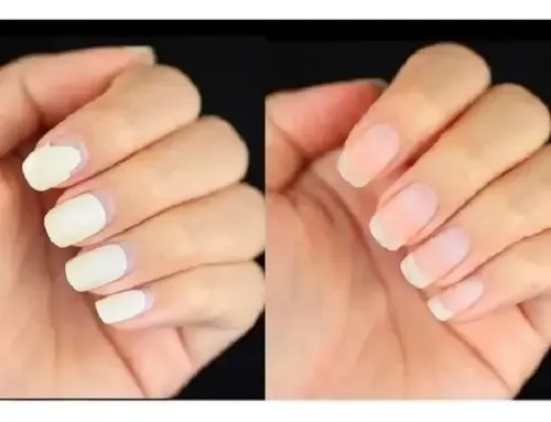 Removedor Mágico De Esmalte Semipermanente 10ml Eloise