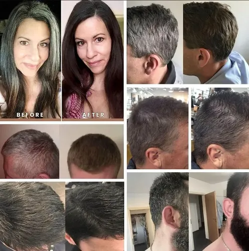 4piezas Jabón Reversor De Canas Oscuras En Pastilla