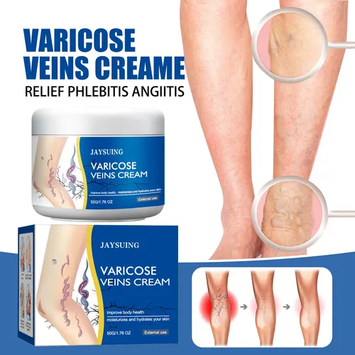 Ki Hh Crema De Venas Varicosas Reducir Las Venas Varicosas