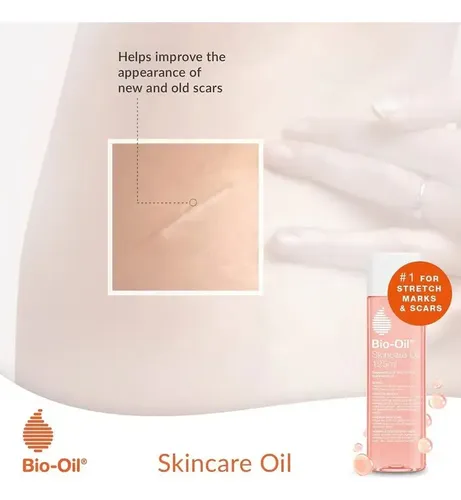 Aceite Bio Oil Tratamiento Para Cicatrices, Estrías, Manchas