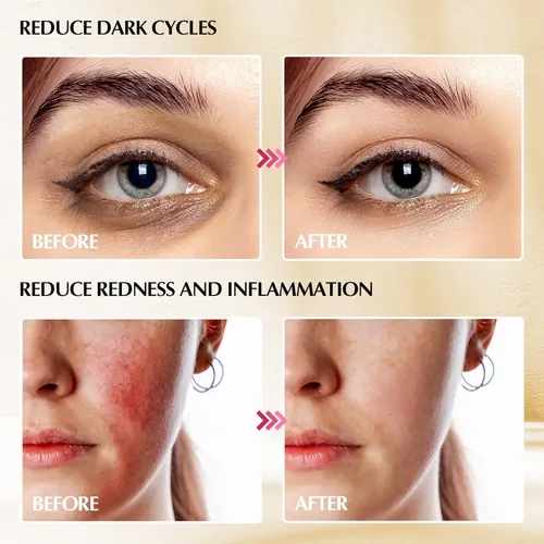 Barra De Masaje De Belleza 2 En 1 De Acero Inoxidable (plata