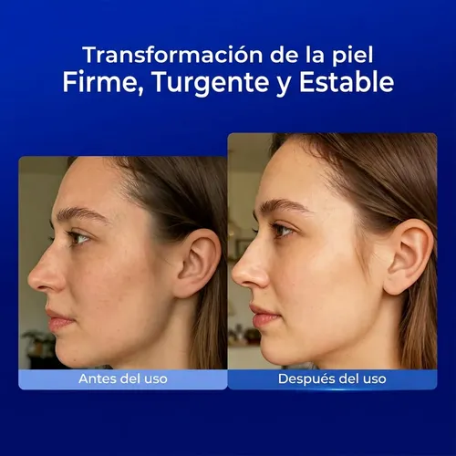 Ampollas Faciales X30 Peptidos Vitamina C Niacinamida