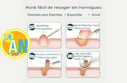 Extractor Puntos Negros Kit Acne 7 Piezas Mascarilla Loan