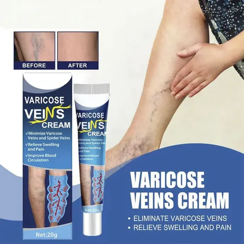 Crema Piernas Varices Estrias Formula Herbal Natural X3