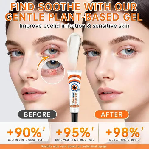 Gel Antifaz Styes Eye Relief Para Blefaritis Y Chalazión, Cr
