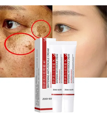 Crema Facial Despigmentante Y Anti Manchas Pack X2 Todo Tipo De Piel Día/noche