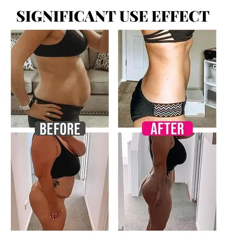 Spray Para Esculpir El Cuerpo – Spr Para Reafirmar La Piel Y