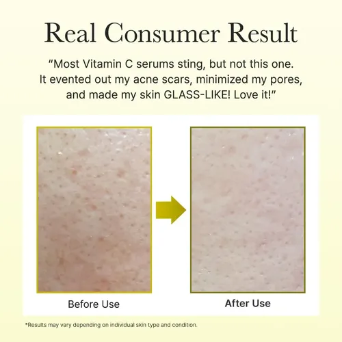 Cccrema Booster Shot Vitamina C Arencia Con Glutatión X2dd