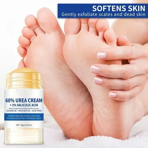 Crema Exfoliante Para Pies Con 60% De Urea, Crema Exfoliante