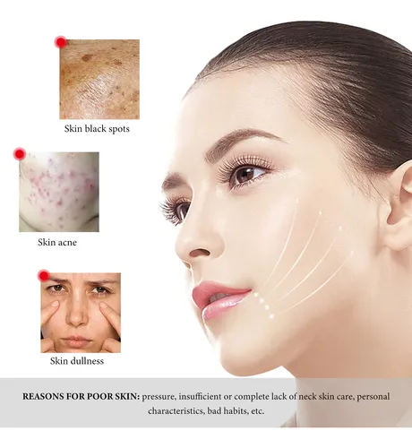 La Crema De Tratamiento Para El Acné Wiyun Limpia E Hidrata  Todo Tipo De Piel