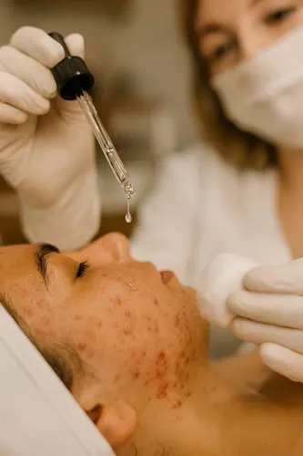 Sérum Cierra Poros Peeling Salicílico 20% Control Acné