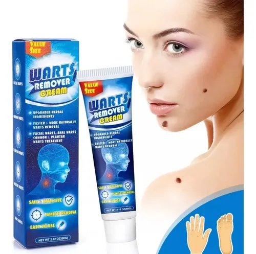 2× 60g Crema Verruga Verruga Pomada For Ojos De Maíz Plana