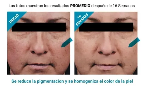 Skinceuticals Phloretin Cf 30 Ml Marca Lider Mundial Todo Tipo De Piel Día/noche