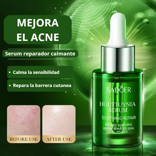 Serum Facial Reparador Calmante Antiacne 30ml – Sadoer Acneica Día/noche