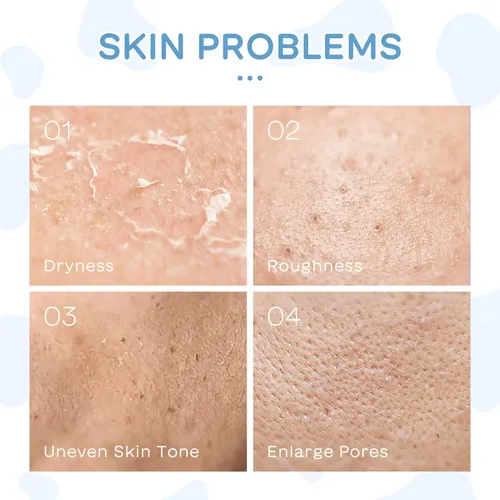 Q2026new Set De Cuidado Facial Leche 5pcs Laikou Piel Suaveg