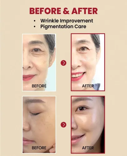 Ksecret Seoul 1988 Serum Liposoma De Retinal 2% + Ginseng