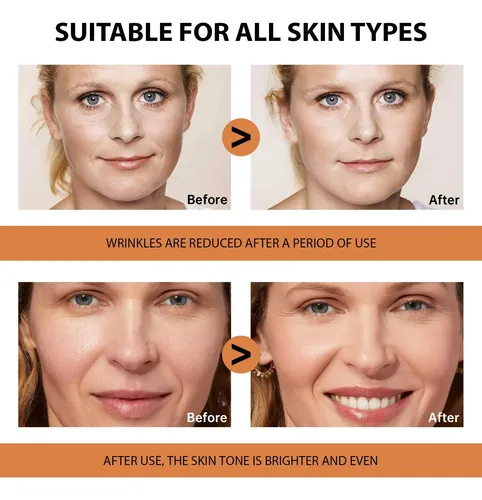 Sérum Facial Vgo Con Vitamina C De Hidratación Profunda, Paq