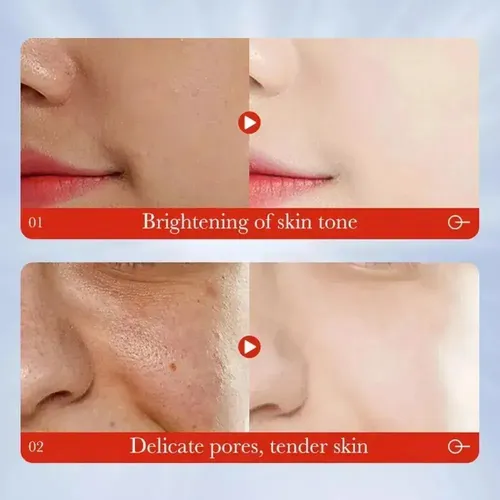 Crema De Ácido Kójico,removedor Manchas Oscuras Cara