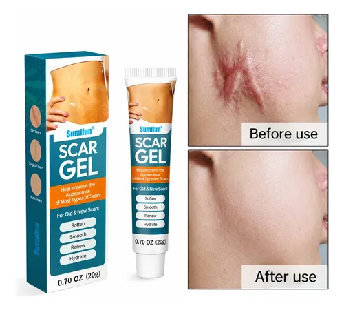 Crema Gel Reparadora Cicatrices Queloide Acne Quemadura Scar