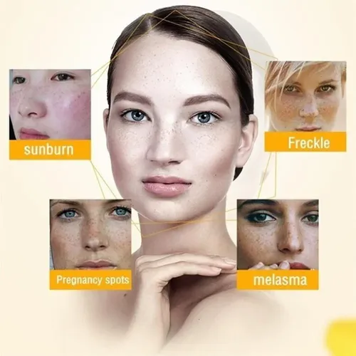 Pomada Reparadora Facial Para Blanquear Manchas, Pecas, Mela