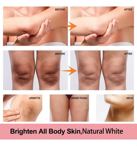 Crema Claradora Vitamínica Para Piel Oscura, Pigmento Yy