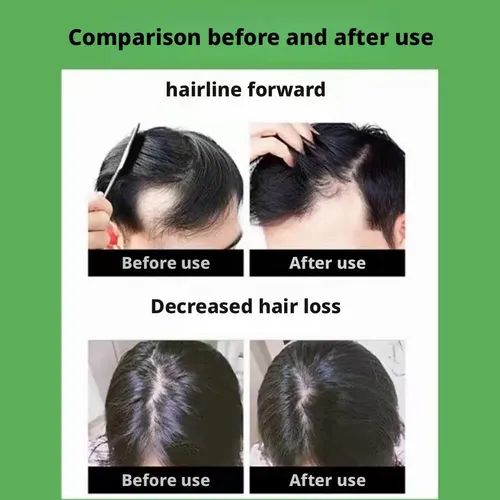 For Neo Hair Lotion Fast Absorbing Natural Hair Recommend
