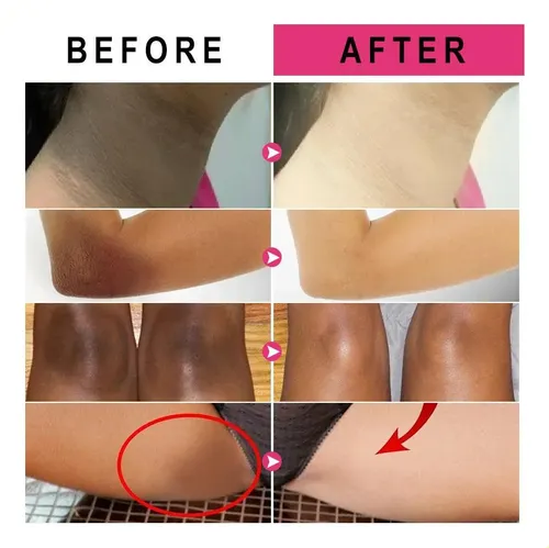 Crema Claradora Vitamínica Para Piel Oscura, Pigmento Yy