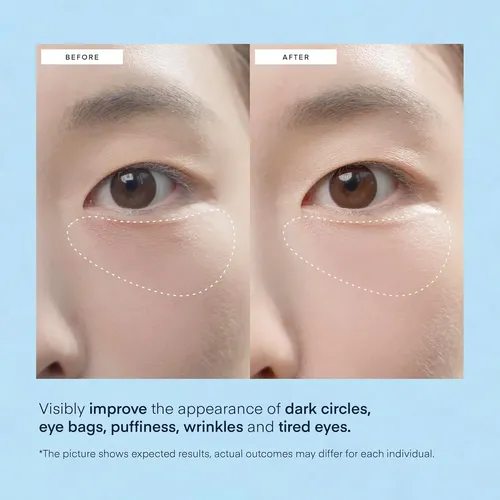 Parches De Hidrogel Para Ojeras Para Debajo De Los Ojos, 60