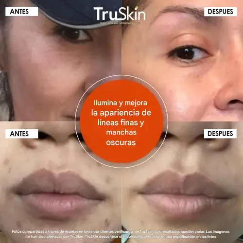 Serum Vitamina C Antimanchas Acido Hialuronico Truskin 30ml