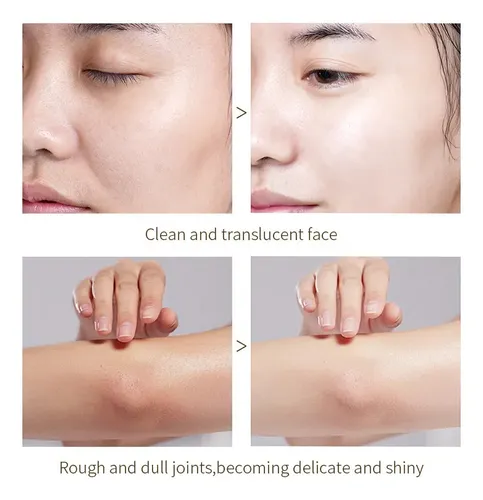 Gel Exfoliante Limpiador Facial Naranja Hombres Y Mujeres