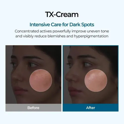 Crema Facial Despigmentante Y Anti Manchas Pack X2 Aurivela