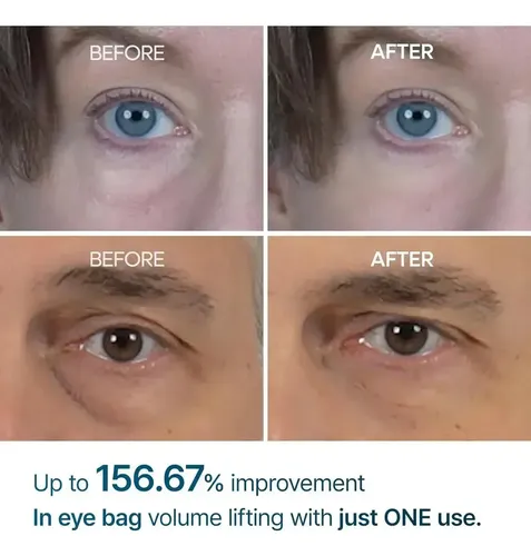Dúo Antiedad Facial Y Ojos Dr.melaxin