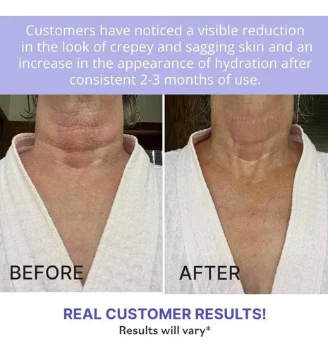 Crema Reafirmante De Cuello Para Reparación De Contornos .