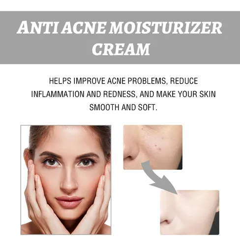 Crema Facial Hidratante Eelhoe Para Rojeces E Imperfecciones