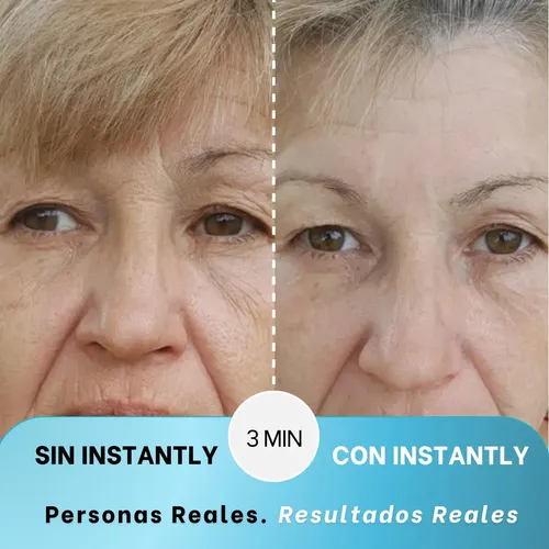 Instantly Ageless – Caja 25 Viales Remueve Arrugas Jeunesse Todo Tipo De Piel Día/noche