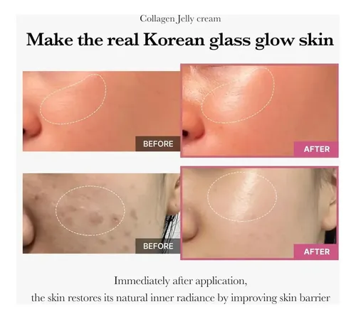 Crema En Gel De Colágeno I 100 Ml Que Hidrata -lys