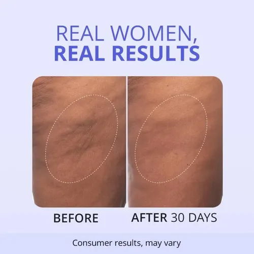 Crema Reafirmante Para Glúteos Y Muslos : Suaviza 2pcs