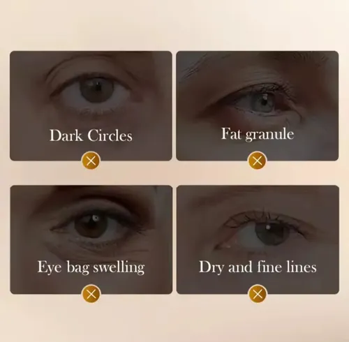 Crema Con Masajeador Veneno De Víbora Ojeras Patas De Gallo Todo Tipo De Piel Día/noche