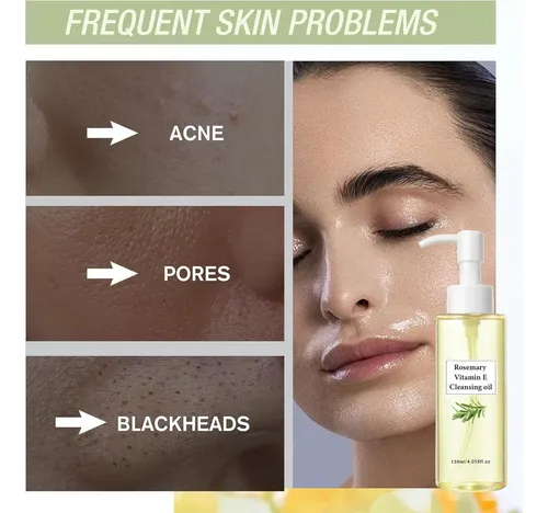 Aceite Limpiador De Romero Y Vitamina E 120 Ml