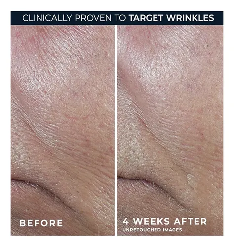 Roc-derm Correxion/retinol Y Antioxidantes/reafirma En Barra
