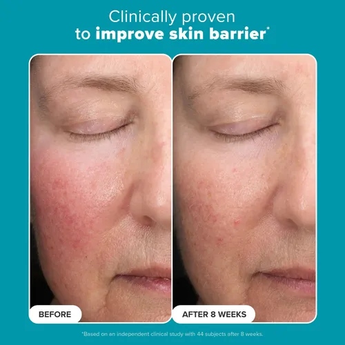 Exfoliante Paula’s Choice 6% De Ácido Mandélico Y 2% De Ácid