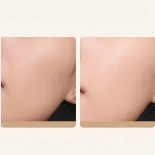 Chando Light Flawless Essence Skin Perfector 2-in-1